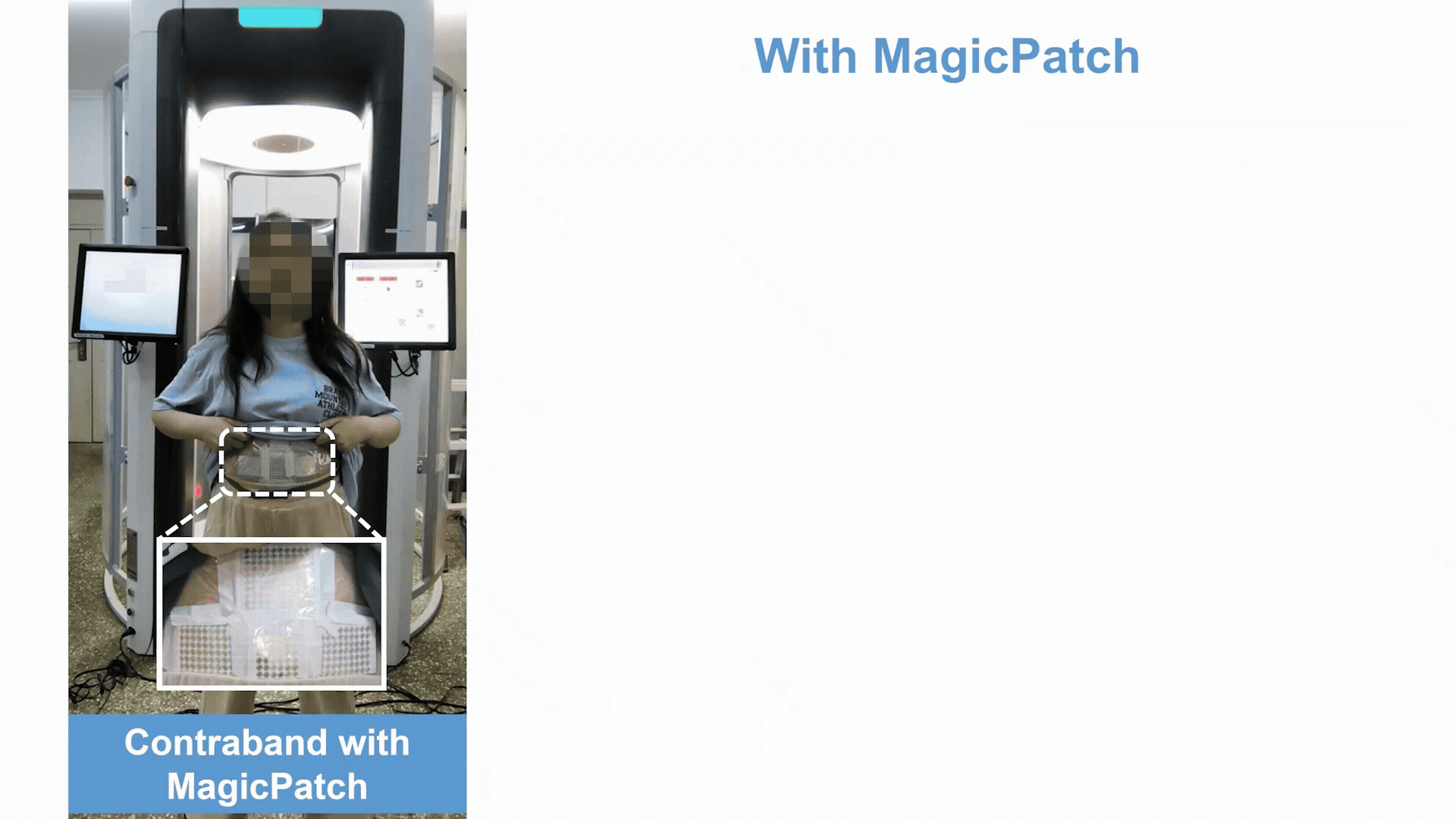 MagicPatch preview